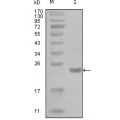 anti-HYAL1 antibody (Hyaluronidase-1) (N-Term)