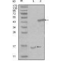 anti-HYAL1 antibody (Hyaluronidase-1) (N-Term)