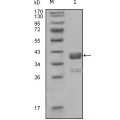anti-HYAL1 antibody (Hyaluronidase-1) (N-Term)