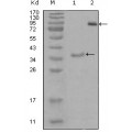 anti-HYAL1 antibody (Hyaluronidase-1) (N-Term)