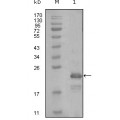 anti-HYAL1 antibody (Hyaluronidase-1) (N-Term)