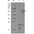 anti-HYAL1 antibody (Hyaluronidase-1) (N-Term)
