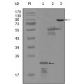 anti-HYAL1 antibody (Hyaluronidase-1) (N-Term)