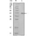 anti-HYAL1 antibody (Hyaluronidase-1) (N-Term)