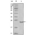 anti-HYAL1 antibody (Hyaluronidase-1) (N-Term)