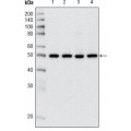 anti-HYAL1 antibody (Hyaluronidase-1) (N-Term)