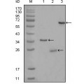 anti-HYAL1 antibody (Hyaluronidase-1) (N-Term)