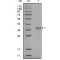 anti-HYAL1 antibody (Hyaluronidase-1) (N-Term)