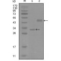 anti-HYAL1 antibody (Hyaluronidase-1) (N-Term)