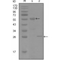anti-HYAL1 antibody (Hyaluronidase-1) (N-Term)
