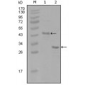 anti-HYAL1 antibody (Hyaluronidase-1) (N-Term)