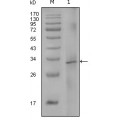 anti-HYAL1 antibody (Hyaluronidase-1) (N-Term)