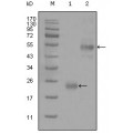 anti-HYAL1 antibody (Hyaluronidase-1) (N-Term)