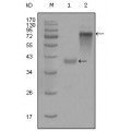 anti-HYAL1 antibody (Hyaluronidase-1) (N-Term)