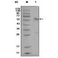 anti-HYAL1 antibody (Hyaluronidase-1) (N-Term)