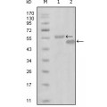 anti-HYAL1 antibody (Hyaluronidase-1) (N-Term)