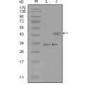 anti-HYAL1 antibody (Hyaluronidase-1) (N-Term)