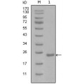 anti-HYAL1 antibody (Hyaluronidase-1) (N-Term)