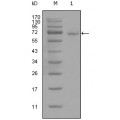 anti-HYAL1 antibody (Hyaluronidase-1) (N-Term)