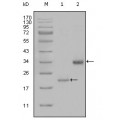 anti-HYAL1 antibody (Hyaluronidase-1) (N-Term)