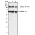 anti-HYAL1 antibody (Hyaluronidase-1) (N-Term)