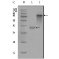 anti-HYAL1 antibody (Hyaluronidase-1) (N-Term)