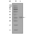 anti-HYAL1 antibody (Hyaluronidase-1) (N-Term)