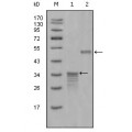 anti-HYAL1 antibody (Hyaluronidase-1) (N-Term)