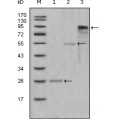 anti-HYAL1 antibody (Hyaluronidase-1) (N-Term)