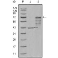 anti-HYAL1 antibody (Hyaluronidase-1) (N-Term)
