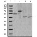 anti-HYAL1 antibody (Hyaluronidase-1) (N-Term)
