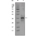 anti-HYAL1 antibody (Hyaluronidase-1) (N-Term)