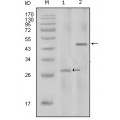 anti-HYAL1 antibody (Hyaluronidase-1) (N-Term)