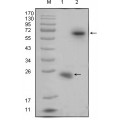 anti-HYAL1 antibody (Hyaluronidase-1) (N-Term)