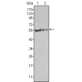 anti-HYAL1 antibody (Hyaluronidase-1) (N-Term)