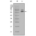 anti-HYAL1 antibody (Hyaluronidase-1) (N-Term)