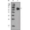 anti-HYAL1 antibody (Hyaluronidase-1) (N-Term)