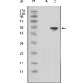 anti-HYAL1 antibody (Hyaluronidase-1) (N-Term)
