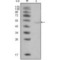 anti-HYAL1 antibody (Hyaluronidase-1) (N-Term)