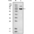 anti-HYAL1 antibody (Hyaluronidase-1) (N-Term)