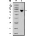 anti-HYAL1 antibody (Hyaluronidase-1) (N-Term)