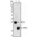 anti-HYAL1 antibody (Hyaluronidase-1) (N-Term)