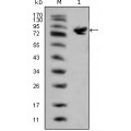 anti-HYAL1 antibody (Hyaluronidase-1) (N-Term)