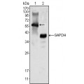 anti-HYAL1 antibody (Hyaluronidase-1) (N-Term)
