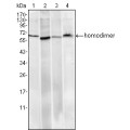 anti-HYAL1 antibody (Hyaluronidase-1) (N-Term)