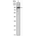 anti-HYAL1 antibody (Hyaluronidase-1) (N-Term)