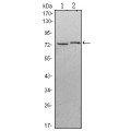 anti-HYAL1 antibody (Hyaluronidase-1) (N-Term)