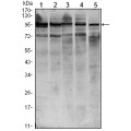 anti-HYAL1 antibody (Hyaluronidase-1) (N-Term)