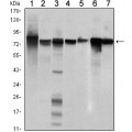 anti-HYAL1 antibody (Hyaluronidase-1) (N-Term)