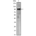 anti-HYAL1 antibody (Hyaluronidase-1) (N-Term)